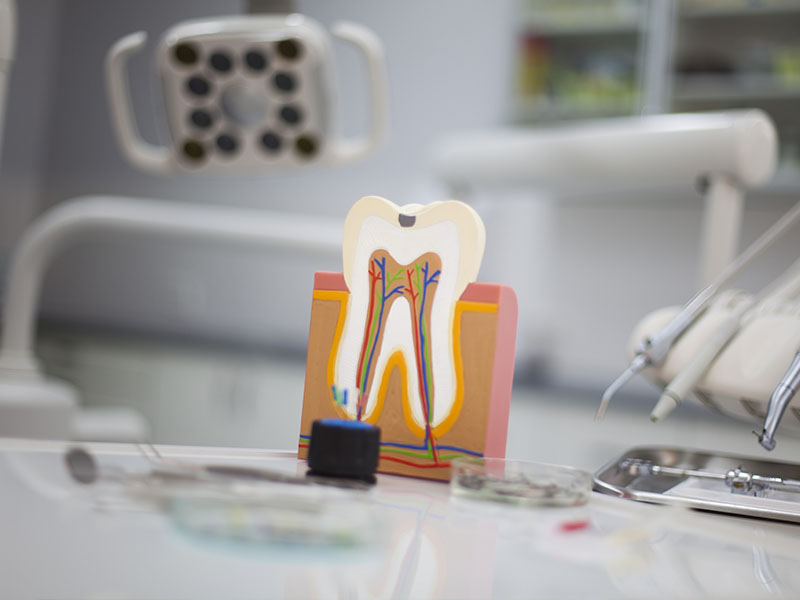 The image shows a dental model with a tooth missing, placed on a stand in front of a dental office setting with various medical equipment and instruments.
