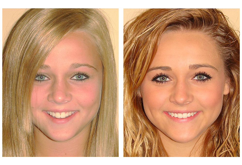 Brightway Dental, PC