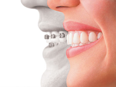 The image is a composite that shows two smiling faces, one of which appears to be a woman s face with teeth and gums, while the other is a man s face with a stethoscope.