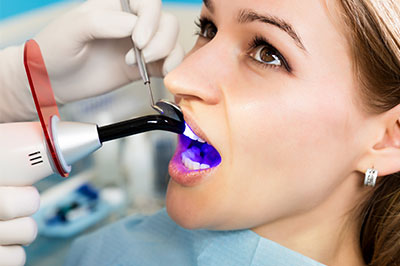 A woman in a dental chair receiving a teeth cleaning, with a hygienist using an ultrasonic scaler to clean her teeth.