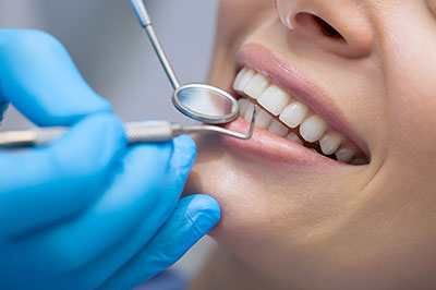 A dental professional performing a teeth cleaning procedure on a patient s mouth.