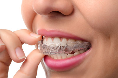 A woman is seen holding a toothbrush with braces attached to it.