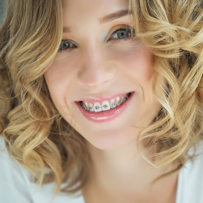 The image shows a smiling woman with braces, wearing makeup and a white top, with blonde hair styled in waves.