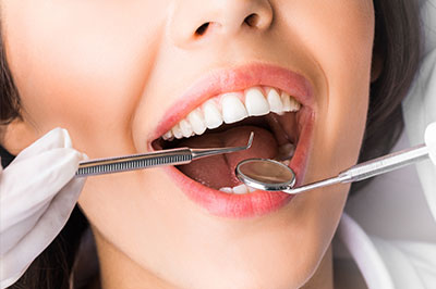 The image shows a woman with an open mouth, surrounded by dental tools such as a spoon and tweezers, suggesting she is in the process of receiving dental care.